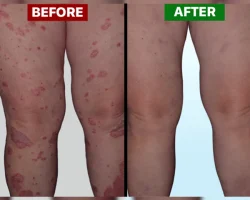 before vs after