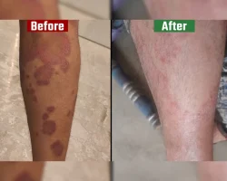 before vs after