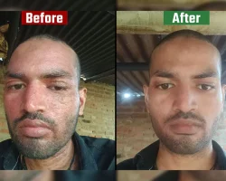 before vs after