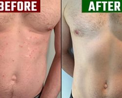 before vs after