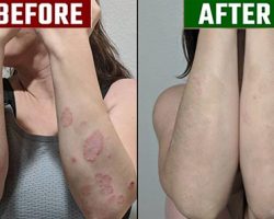 before vs after