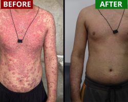 before vs after