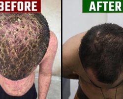 before vs after
