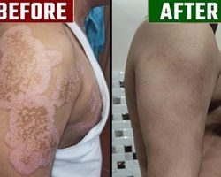 before vs after