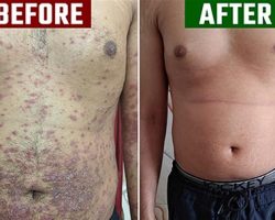 before vs after